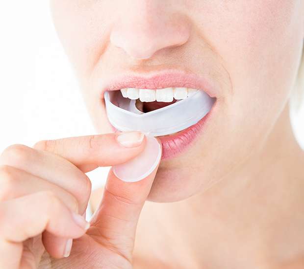 Sonoma Mouth Guards